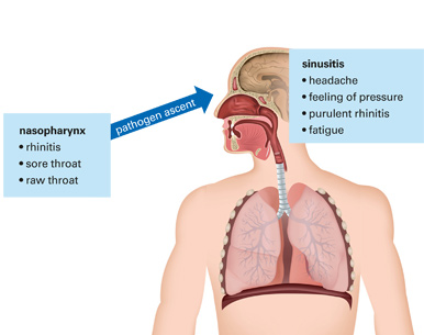 Fig. 2: Direction of propagation of the pathogens