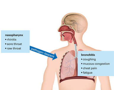 Fig. 2: Direction of propagation of the pathogens