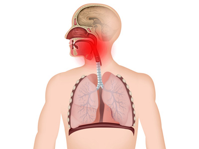 Pharyngitis/Tonsillitis